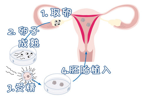有偿同志供卵咨询怎么找